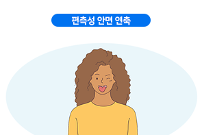 편측성 안면 연축