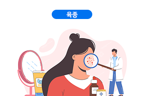 육종